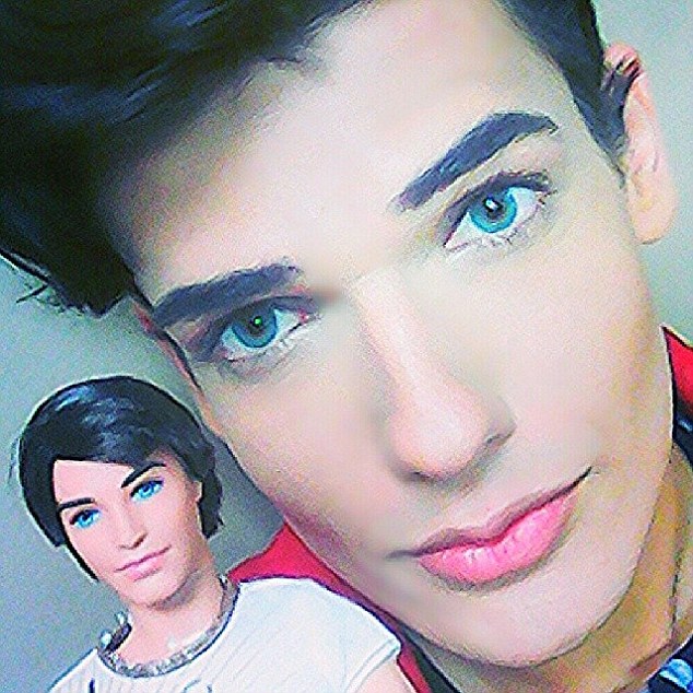 巴西男?；ㄙM31萬元整容成&ldquo;芭比男友&rdquo;