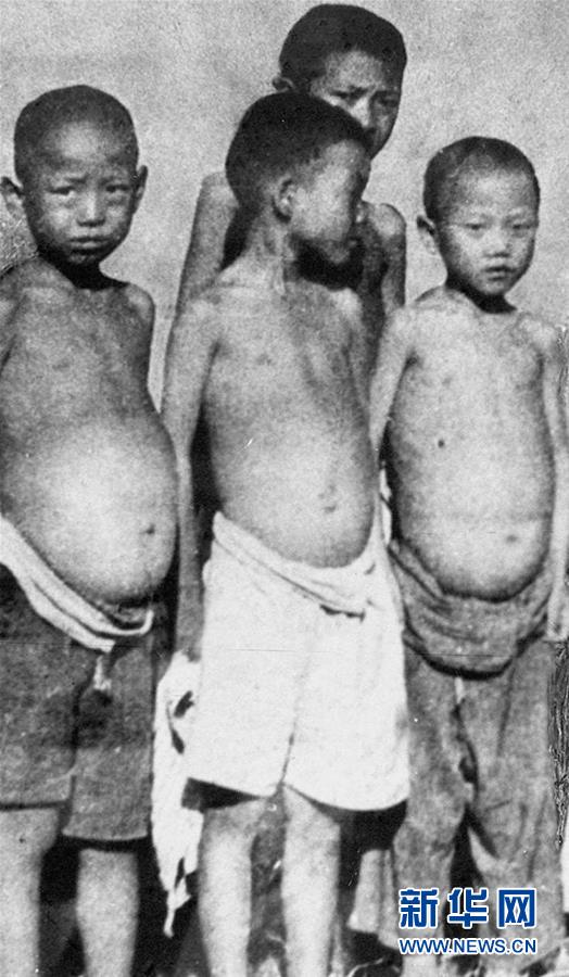 （紅土地&ldquo;往事新說(shuō)&rdquo;&middot;圖文互動(dòng)）（6）昔日送&ldquo;瘟神&rdquo;  今朝健康促小康