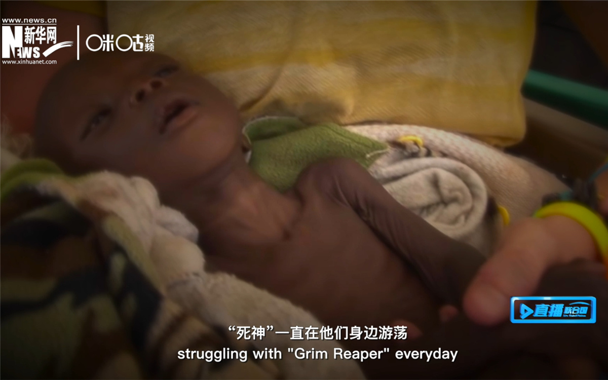 全球五歲以下嚴(yán)重急性營(yíng)養(yǎng)不良的孩子約有一千六百萬(wàn)人